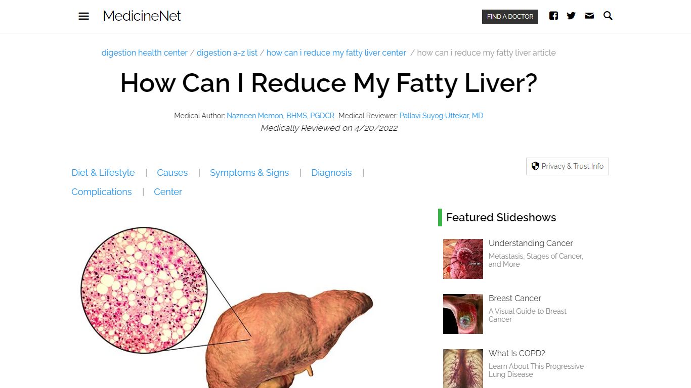 How Can I Reduce My Fatty Liver? 10 Diet & Lifestyle Tips - MedicineNet